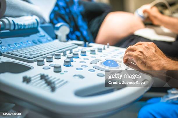 close up to an ultrasound device - medical technologist stock pictures, royalty-free photos & images