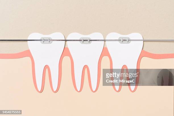 teeth with braces cartoon paper cut craft - menselijke mond stockfoto's en -beelden