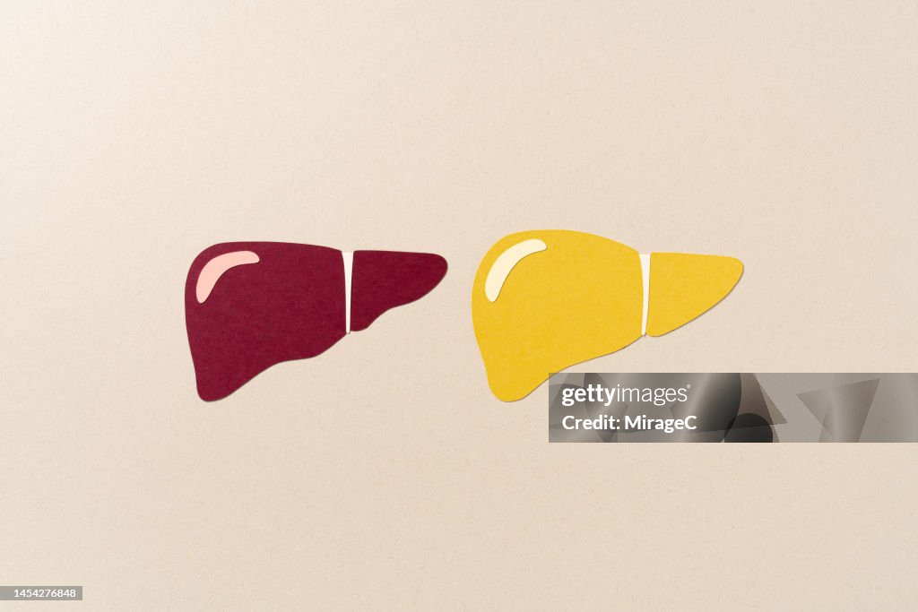 Healthy Liver Compared to Fatty Liver Paper Cut Craft