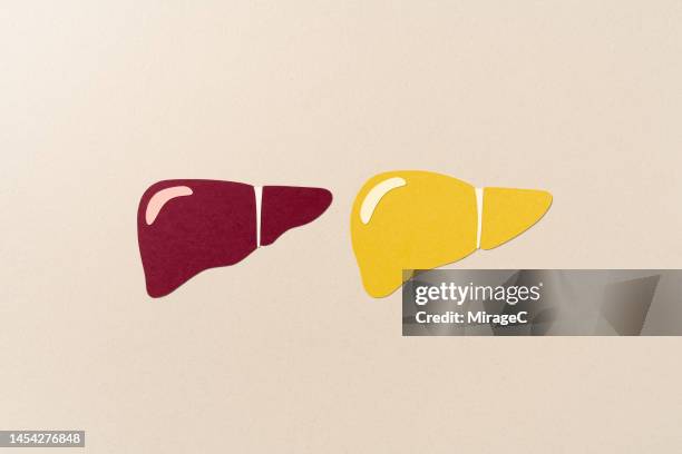 healthy liver compared to fatty liver paper cut craft - cirrhosis 個照片及圖片檔