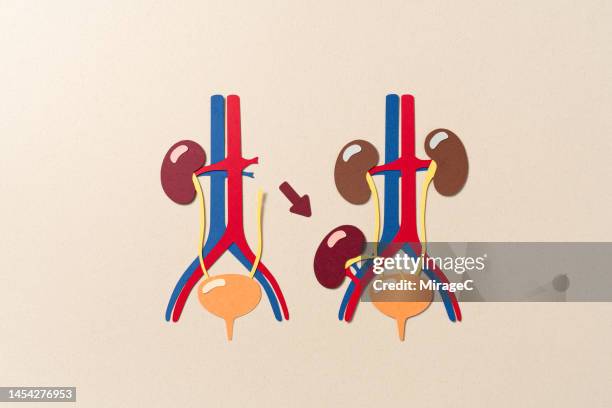 kidney transplant anatomy diagram paper craft - kidney donation stock pictures, royalty-free photos & images