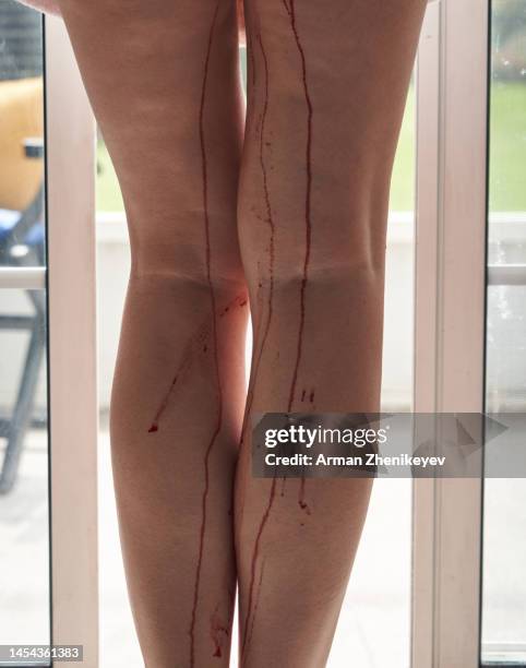 blood runs down on womans legs - gram stain stock-fotos und bilder