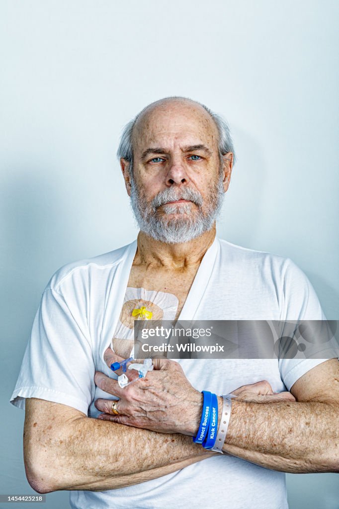 Cancer Patient Chemotherapy IV Drip Chest Port