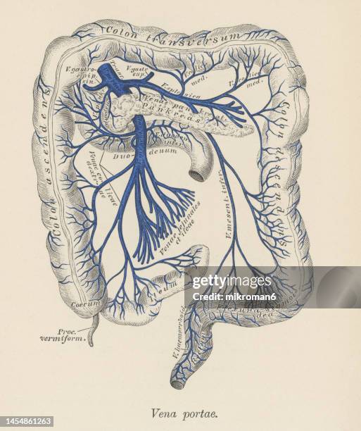 Ubicación De La Vena Mesentérica Inferior Vena Cava Inferior