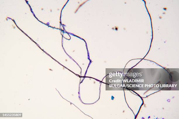 tissue fibres, light micrograph - lms stock pictures, royalty-free photos & images