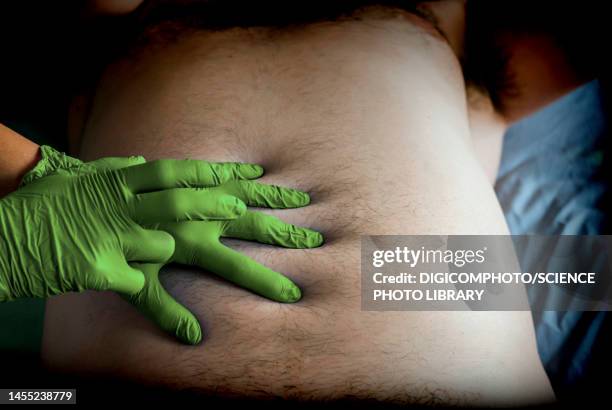 doctor examining a patient's abdomen, conceptual image - magen stock-fotos und bilder