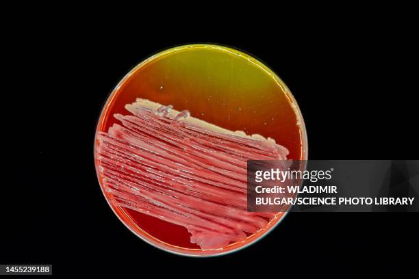 bacteria cultured on petri dish - petri dish stock-fotos und bilder