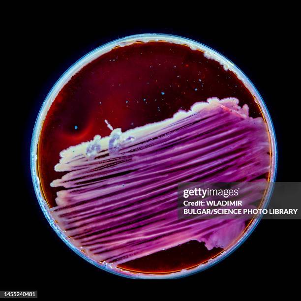 bacteria and fungi cultured on petri dish - science photo library photos et images de collection