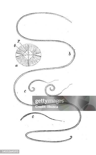 antique biology zoology image: filaria medinensis - roundworm stock illustrations