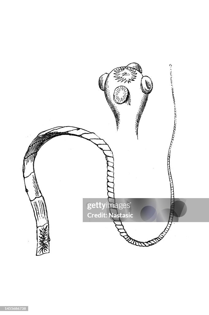 Pork Tapeworm (Taenia Solium)