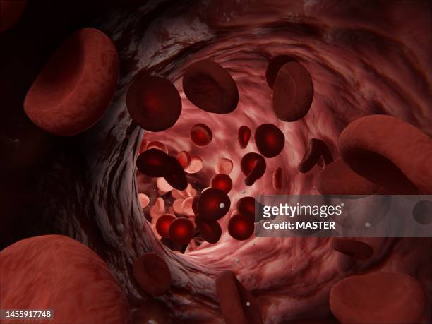 circulatory system - red blood cells flowing in an artery - lupus stock-fotos und bilder