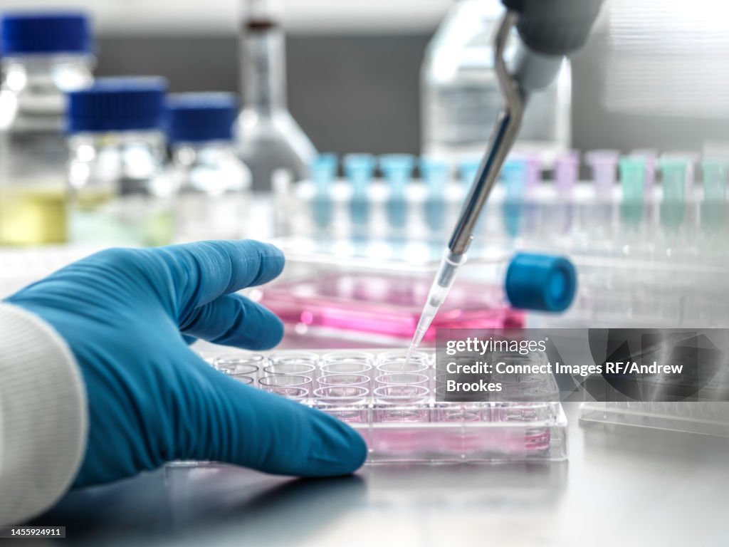 Scientist pipetting medical samples into microplate in laboratory