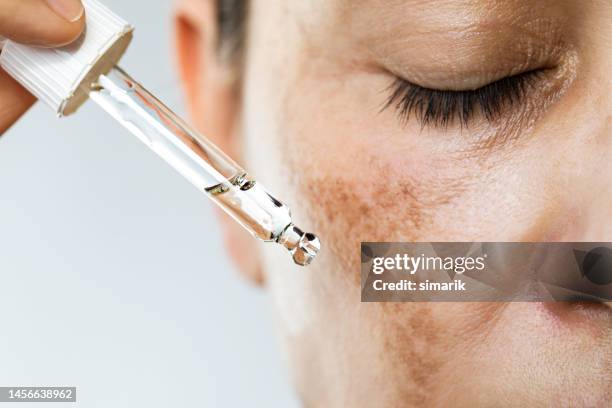 hyperpigmentation - mulher aging scientific imagens e fotografias de stock