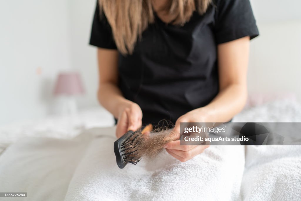 Pérdida de cabello mujer stock phot.