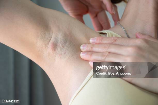 cropped shot of woman having swollen axillary lymph nodes under her armpit. - arm pit ストックフォトと画像