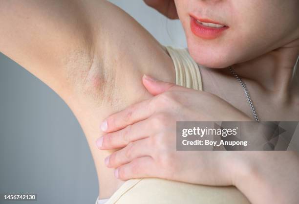 cropped shot of woman having swollen axillary lymph nodes under her armpit. - boy armpit stock-fotos und bilder