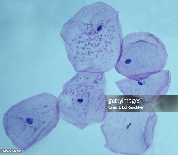 squamous epithelial cells, show major cell structures--nucleus, cytoplasm and cell membrane 100x - cellulose fotografías e imágenes de stock
