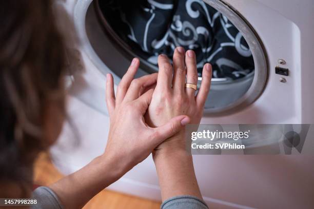 housewife scratches dermatitis on the skin of her hand during household chores. - atopic eczema stock pictures, royalty-free photos & images