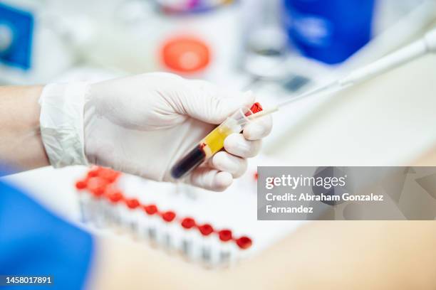 pipette taking samples from a tube in an analysis laboratory - hiv test 個照片及圖片檔