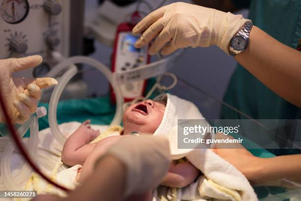 newborn baby in surgery room at hospital - pediatric intensive care unit stock pictures, royalty-free photos & images