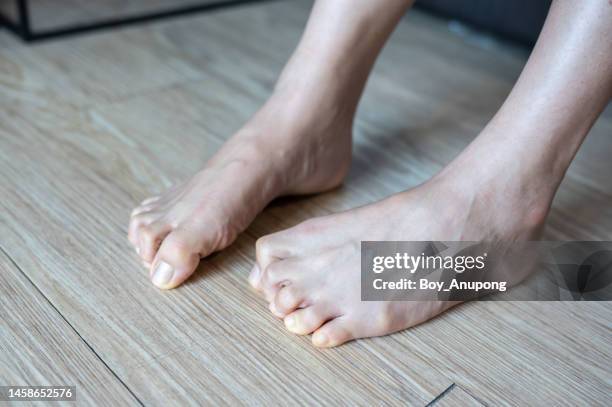 cropped shot of woman legs having toe spasms. - paralysis stock pictures, royalty-free photos & images