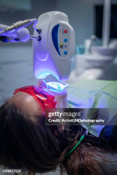 donna in trattamento dentale per sbiancare i denti. - sbiancamento dentale foto e immagini stock