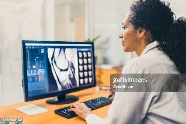 radiologist analysing the images from the mri scan - radioloog stockfoto's en -beelden