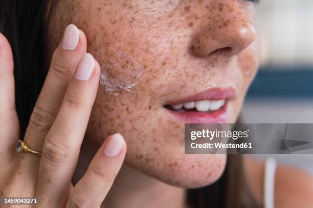 hand of woman applying moisturizer on face - faces freckles stockfoto's en -beelden