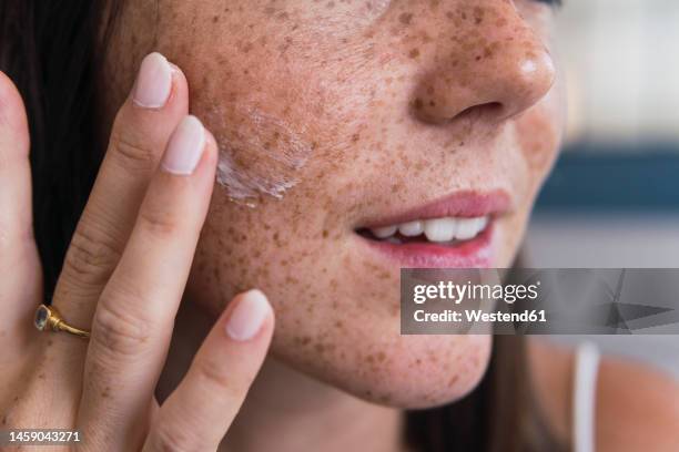 hand of woman applying moisturizer on face - freckle stock pictures, royalty-free photos & images