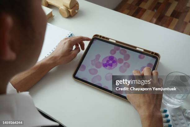 asian men looking a blood leukemia cells by digital tablet to know the stage of your own leukemia. - platelet stock pictures, royalty-free photos & images