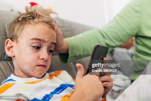 mother puts an lotion on her son's skin,to reduce the itching of chicken pox, while he playing video games on mobile phone - chickenpox 個照片及圖片檔