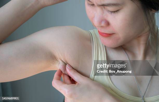 close up of asian woman having swollen axillary lymph nodes under her armpit. - swollen fotografías e imágenes de stock