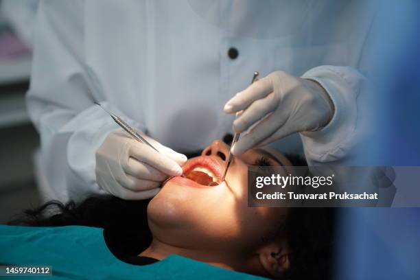 dentist checking patient's teeth . - tandarts stockfoto's en -beelden
