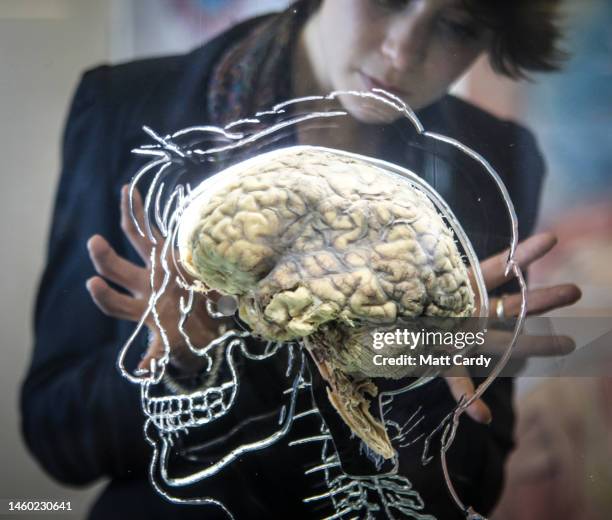 Real human brain is displayed as part of a exhibition at the @Bristol attraction on March 10, 2011 in Bristol, England. The Real Brain exhibit -...