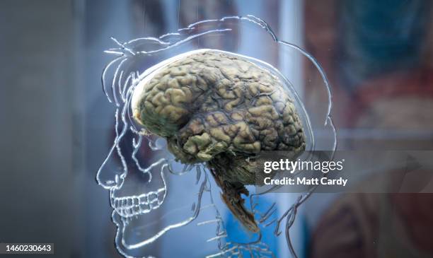 Real human brain is displayed as part of a exhibition at the @Bristol attraction on March 10, 2011 in Bristol, England. The Real Brain exhibit -...