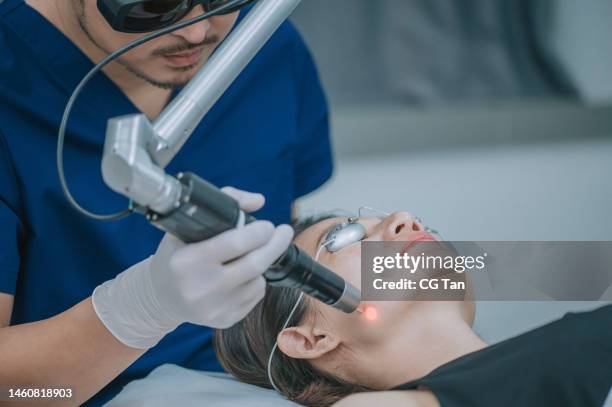asian chinese male aesthetician laser ipl treatment on his female patient in clinic - hyperpigmentation stockfoto's en -beelden