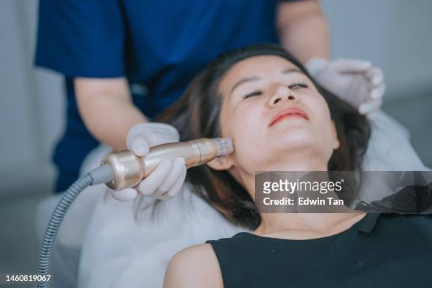 asian chinese female aesthetician giving microdermabrasion treatment to her patient - pores stockfoto's en -beelden