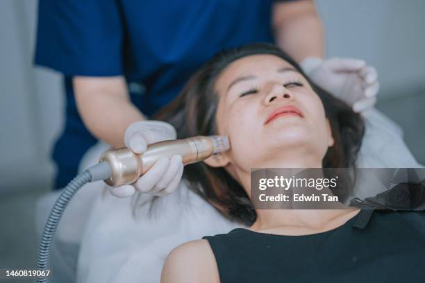 asian chinese female aesthetician giving microdermabrasion treatment to her patient - hyperpigmentation stock pictures, royalty-free photos & images