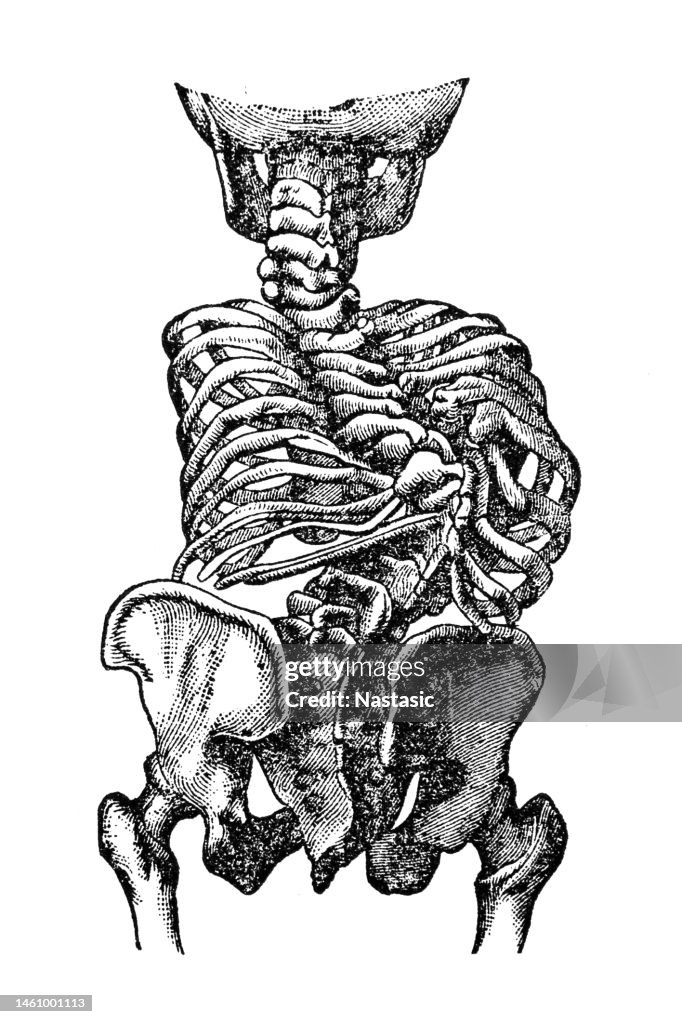 Spine degeneration