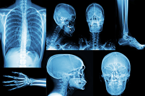 Nano-X Imaging: Cash Burn Makes It A Hold (NASDAQ:NNOX) Nano-X Imaging: Cash Burn Makes It A Hold (NASDAQ:NNOX)