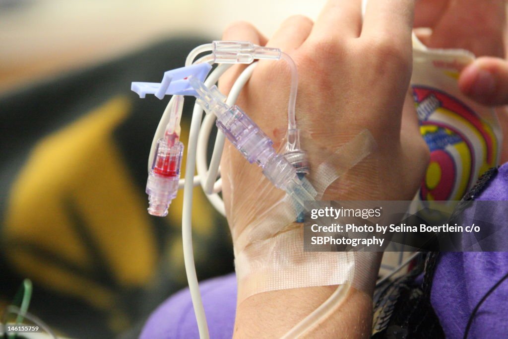 Chemo day