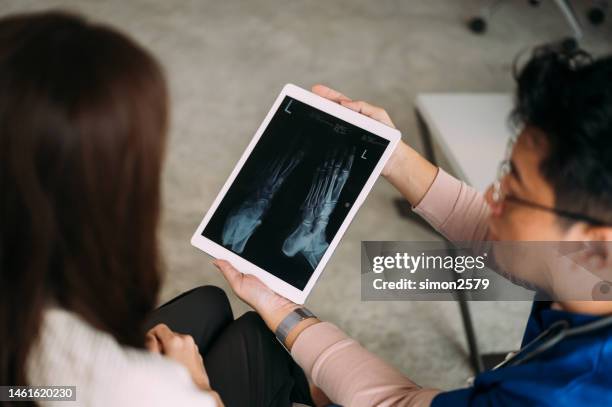 male doctor advising his female patient broken leg in ankle brace checking x-ray tablet - foundation conversations screening of get out stock pictures, royalty-free photos & images