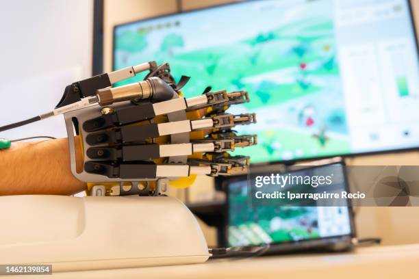 mechanical exoskeleton hand. physiotherapy in a modern hospital: detail of the hand of the patient in the rehabilitation exercises with the mechanical hand, watching the computer games. scientists, engineers and physiotherapy rehabilitation doctors use a - fake hospital stock-fotos und bilder