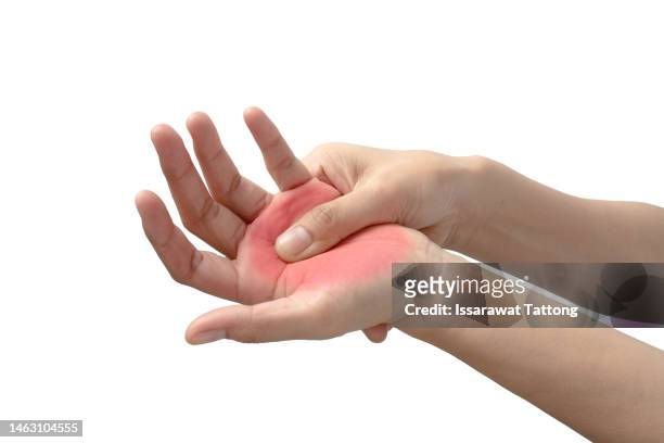 130 Hand Injury Palm Photos and Premium High Res Pictures - Getty Images