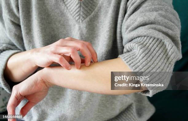 scratching - jucken stock-fotos und bilder