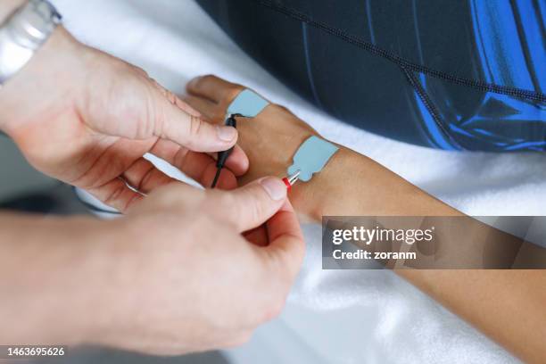 applying electrodes on patient's hand for electrostimulation therapy - electrode stock pictures, royalty-free photos & images