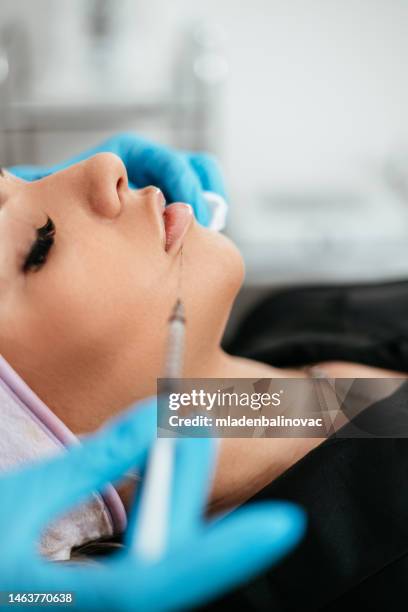 modern beauty treatment - lip injections stockfoto's en -beelden