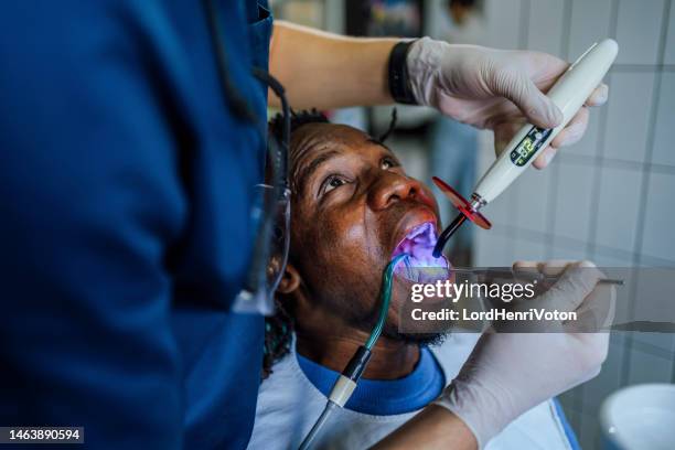 dentist repairing patient teeth in the dentist's clinic - dental calculus stock pictures, royalty-free photos & images