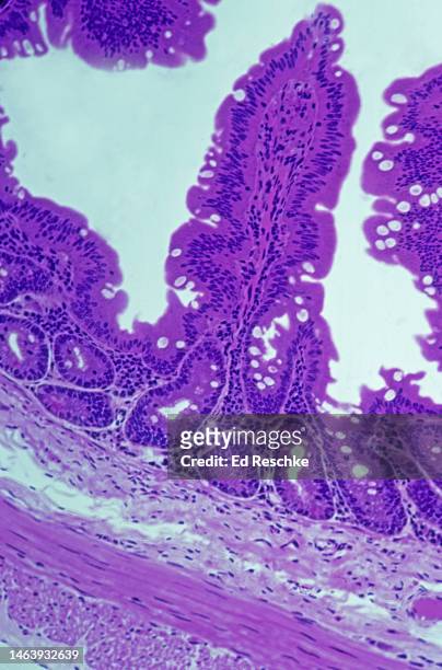 small intestine layers--mucosa, submucosa, muscularis, serosa--jijunum 50x - simple columnar epithelial cell ストックフォトと画像