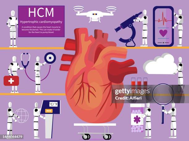 hypertrophic cardiomyopathy - cardiomyopathy stock illustrations